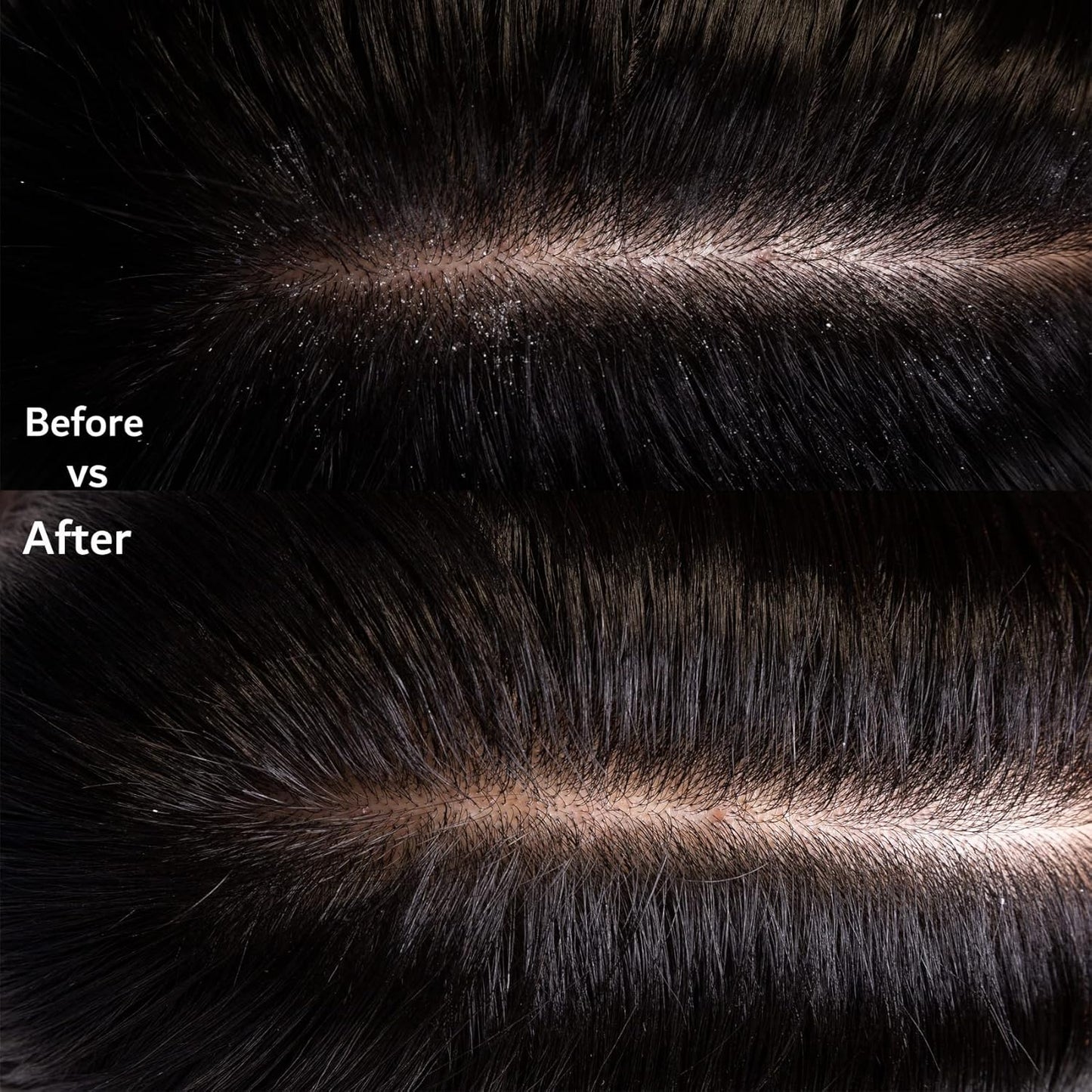Voir Serum Cabello Graso y Cuero Cabelludo Irritado 30ml